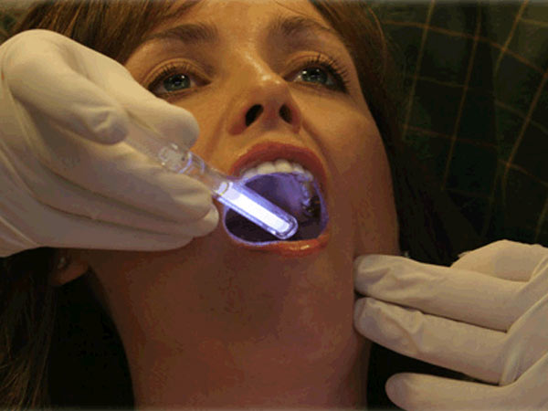 Examining a patient's mouth