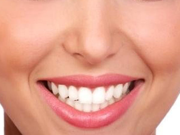 Hollywood smile