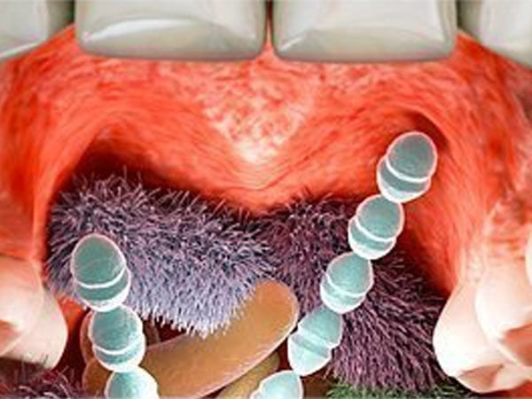 Inside a mouth