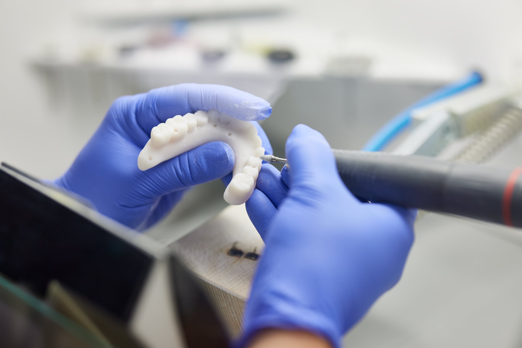 Dental professional making a dental prosthetic for implants