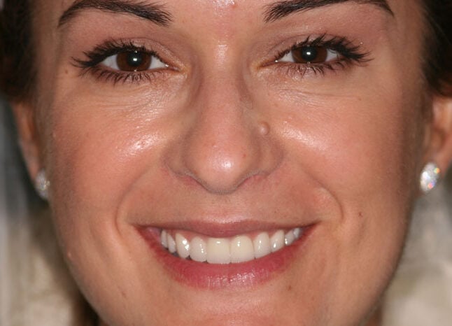Close-Up Photo of a Person Smiling