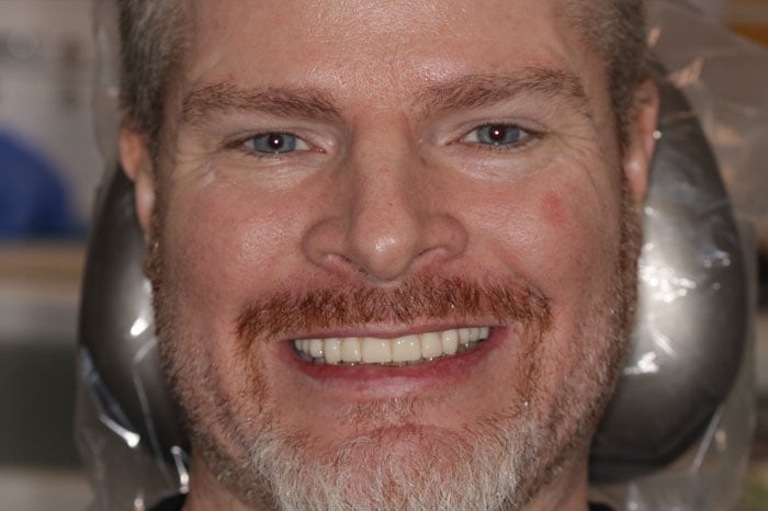 Jones' Present Smile