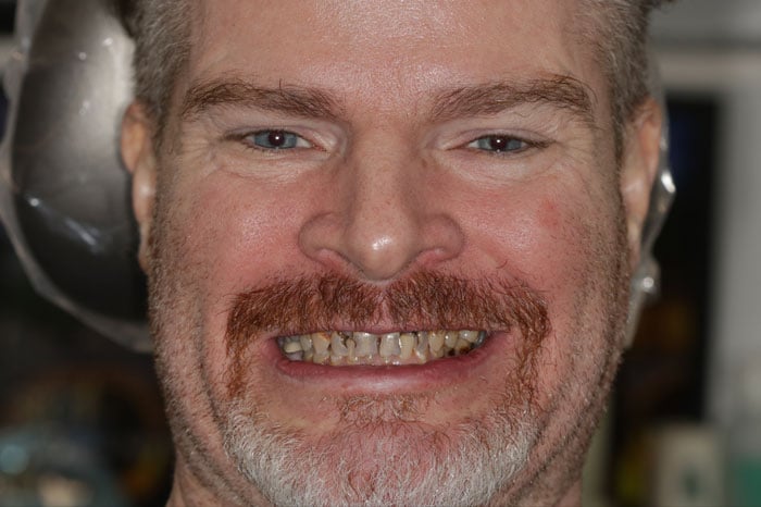 Jones' Past Smile